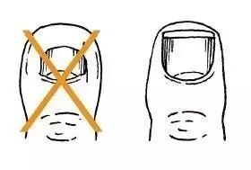 糖尿病足负压护理及观察要点,糖尿病足居家护理