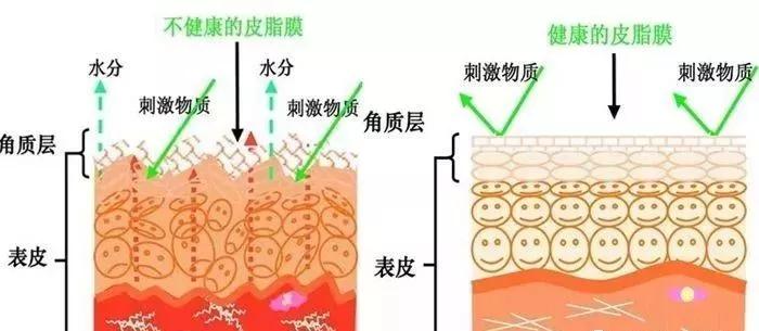 激素脸皮肤红烫是怎么回事,皮肤问题一直查不出原因