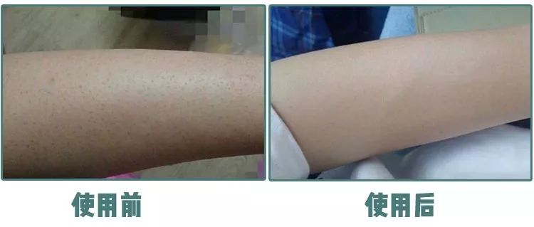 张韶涵护肤三周养皮,燕窝水漾嫩肤精华面膜包文婧