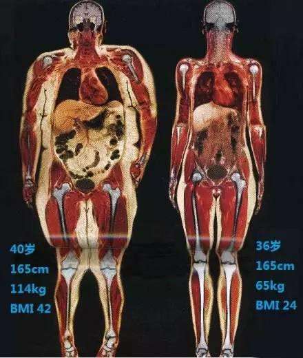 你和男朋友谁的腿细？腿粗不可怕，就怕有文化