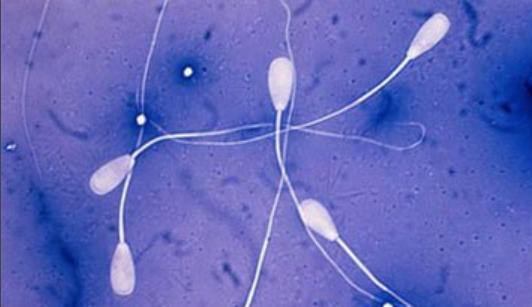 避孕的四大错误,这4种避孕方法不靠谱别再用了