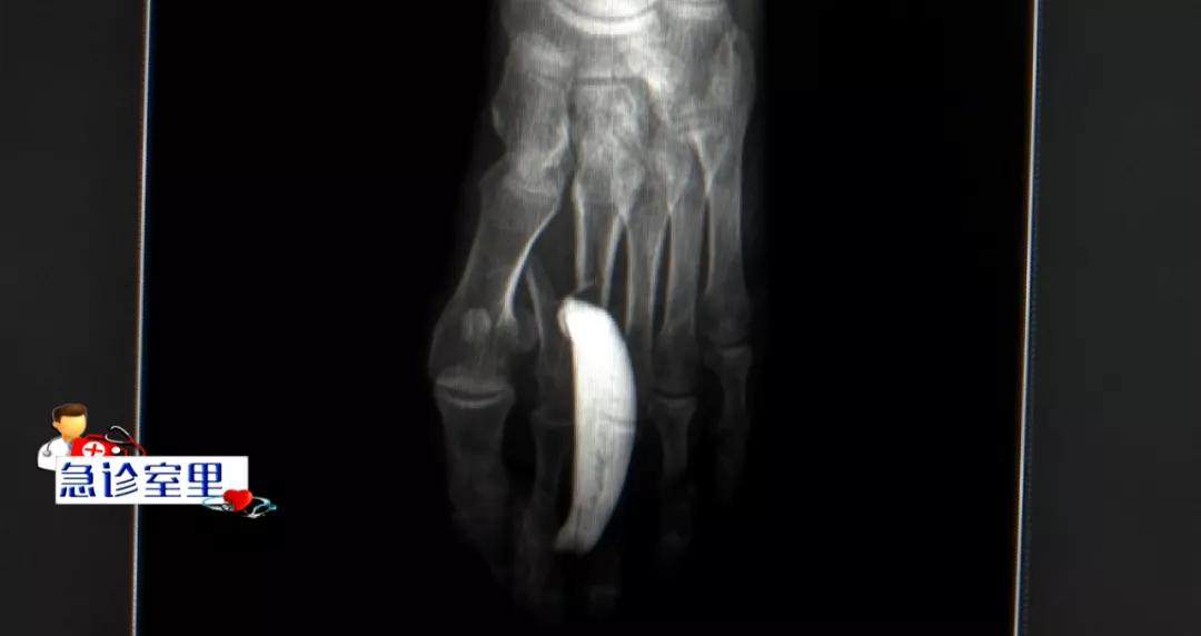 被电动车追尾电动车的人受伤了,被电动车撞的老太太