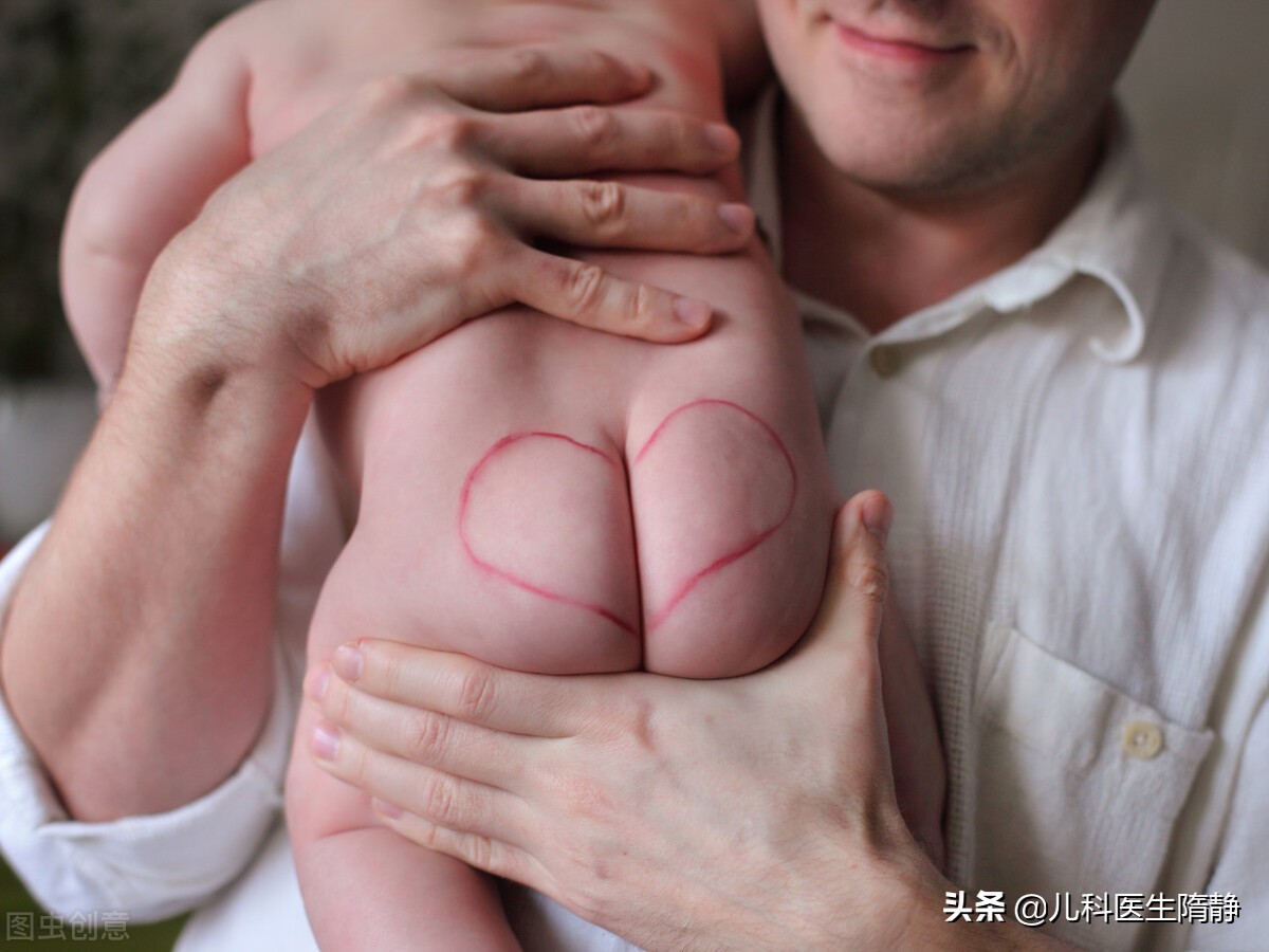 宝宝红屁屁哭闹怎么办,宝宝有了红屁屁怎么办