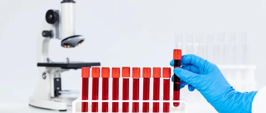 红斑狼疮血小板低会有怎样的后果,红斑狼疮血小板低