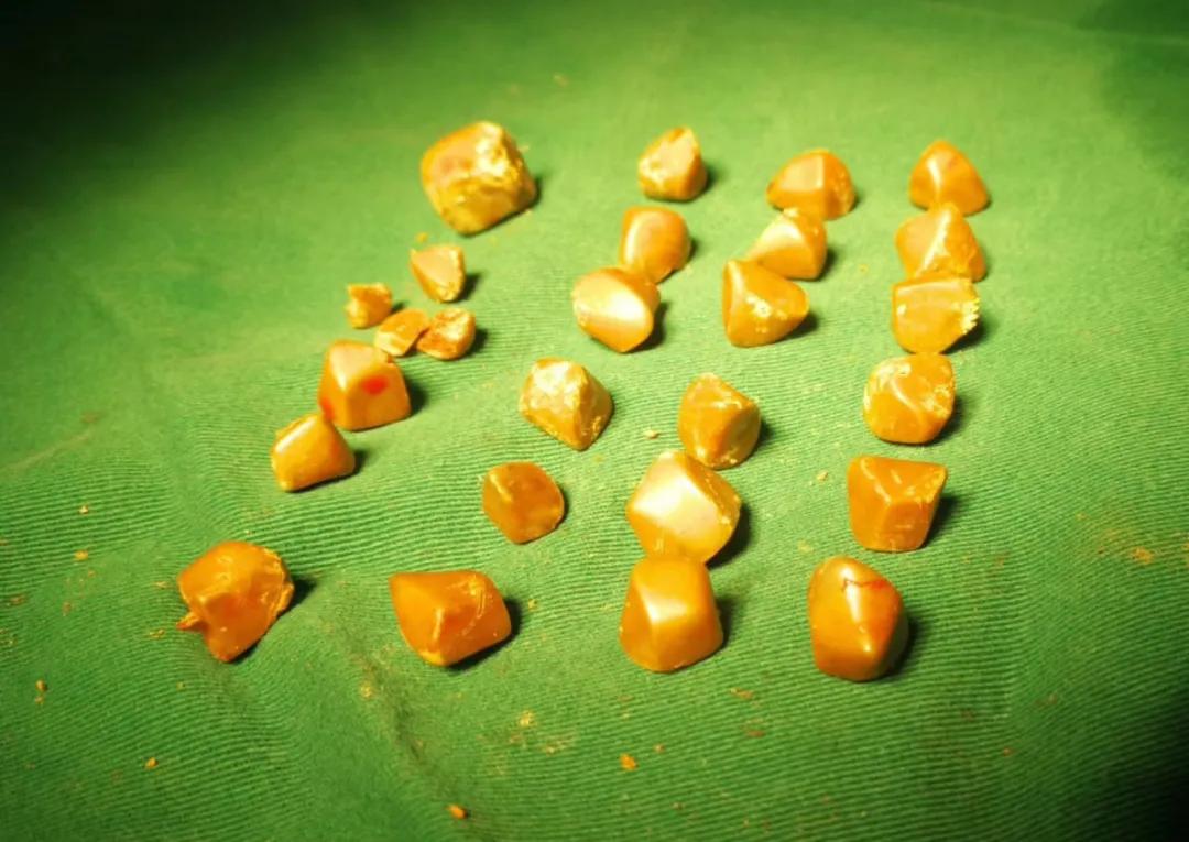 曲靖中医医院微创,曲靖市中医医院微创技术怎么样