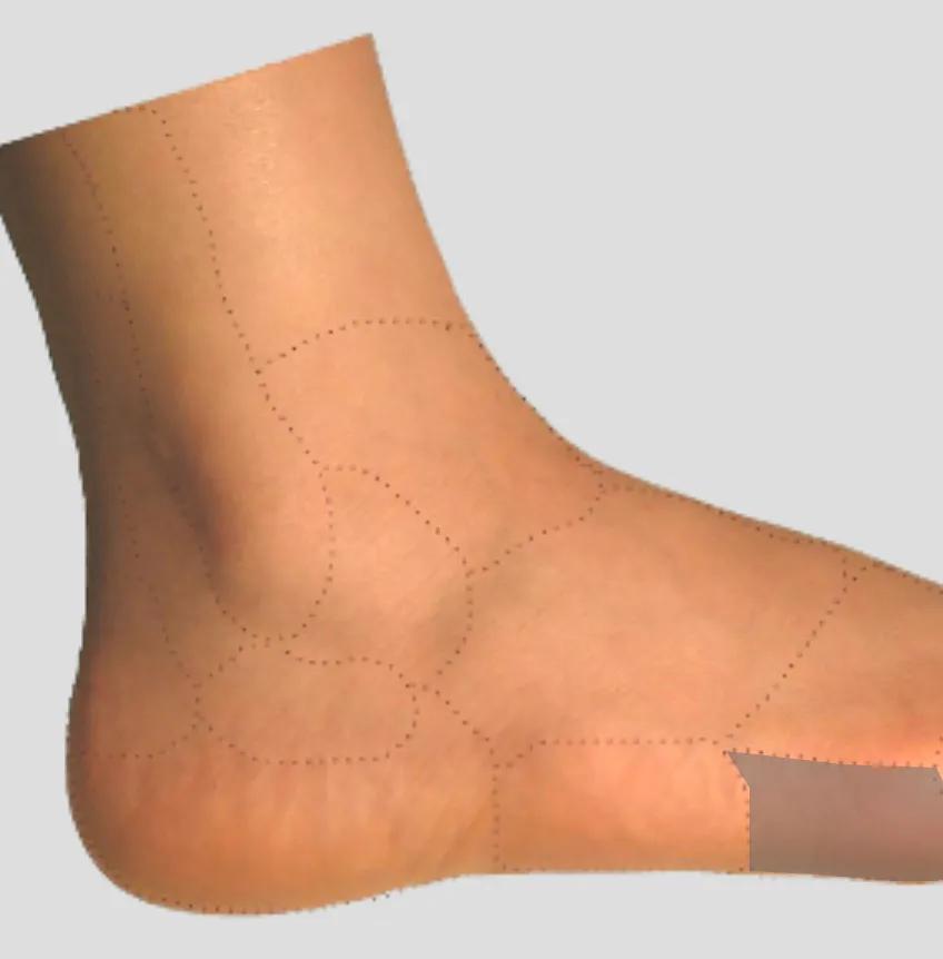 足踝外侧疼痛部位对照表,足踝外侧疼痛的处理方法