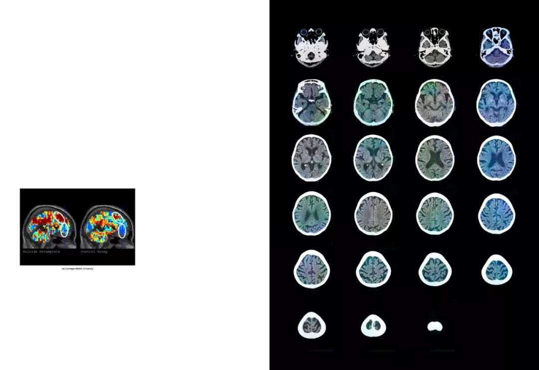 日本每年3万人自杀,韩星自杀成风…他探访3大自杀圣地,让人心惊