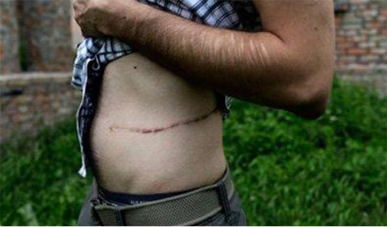 尼泊尔肾谷在哪里,尼泊尔肾谷现状