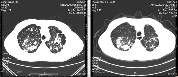 屋漏偏逢连夜雨神回复,屋漏偏逢连夜雨出处