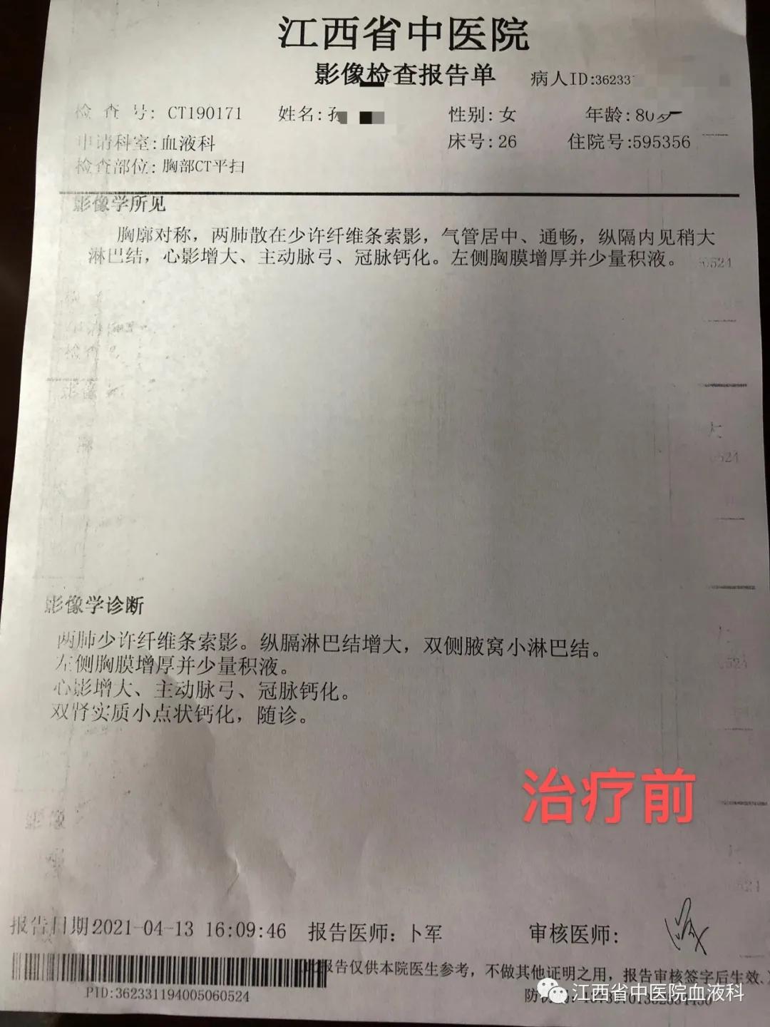 老人淋巴瘤保守治疗西医怎么治,中西医结合治愈多发性骨髓瘤
