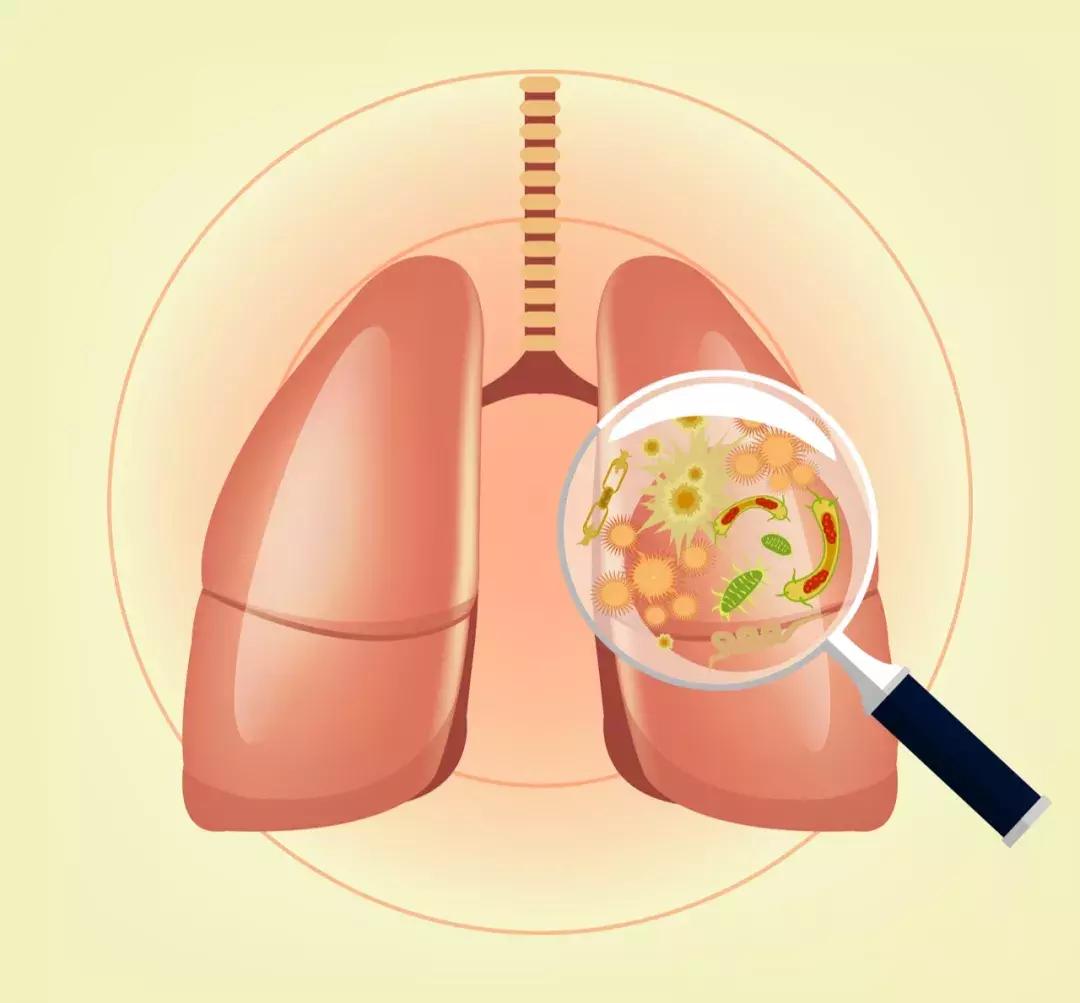 宝宝得了肺炎怎么安慰宝妈,宝宝得肺炎怎么办