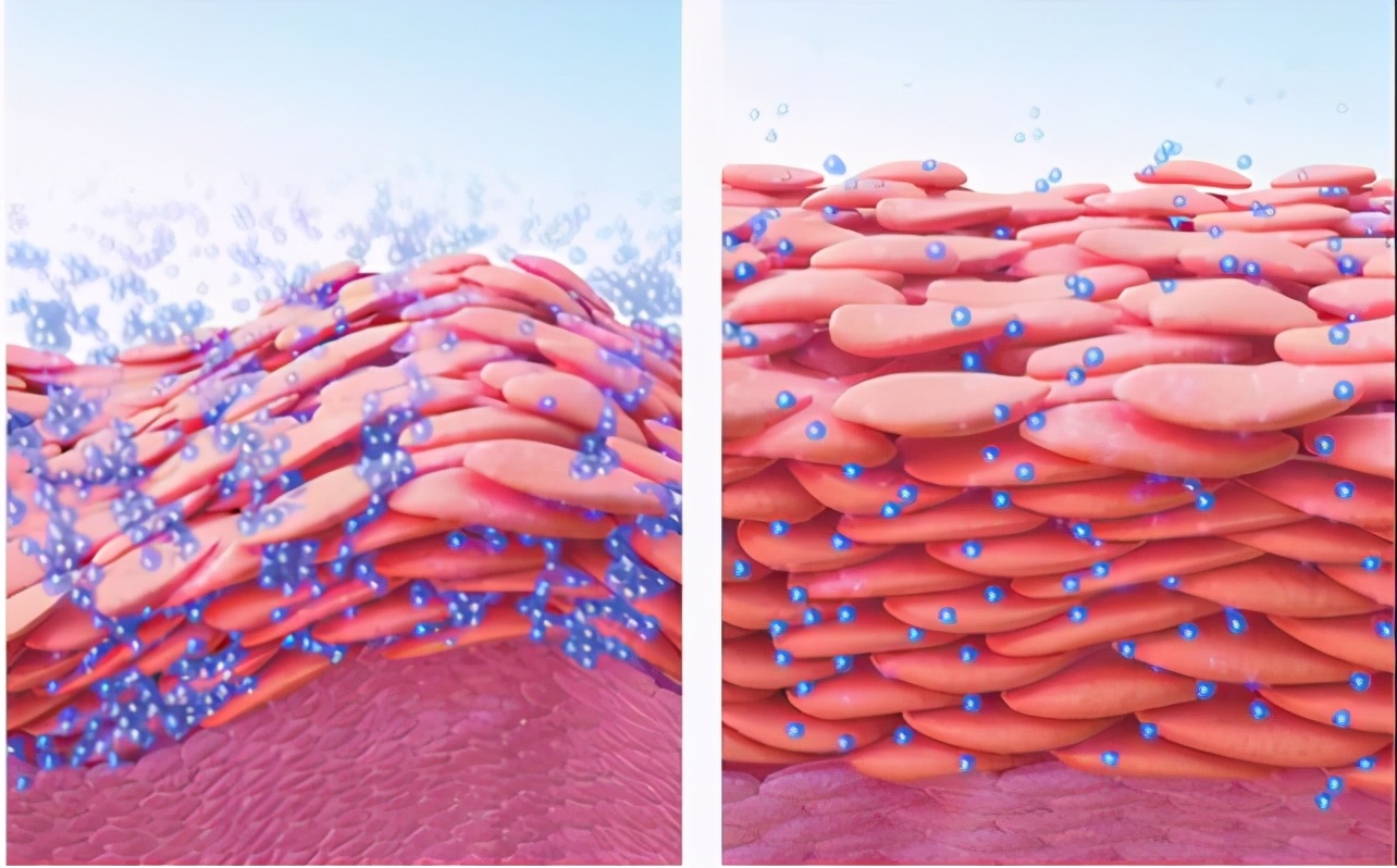 为什么都说面膜是智商税,面膜真的能补水还是智商税