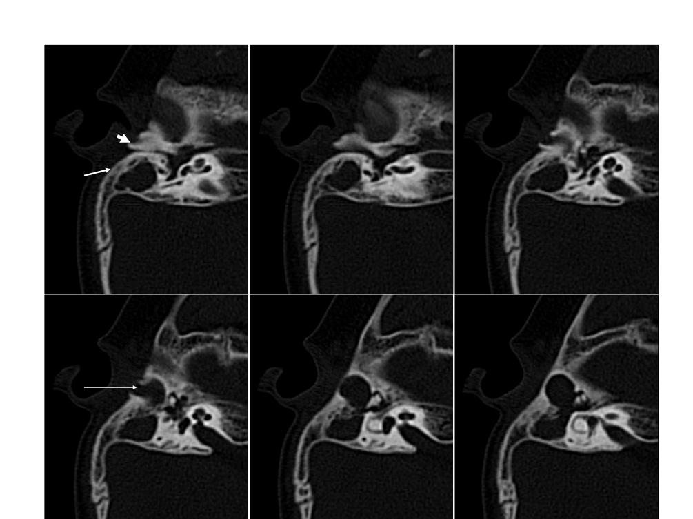 车祸头部外伤症状,车祸头部受伤后期症状