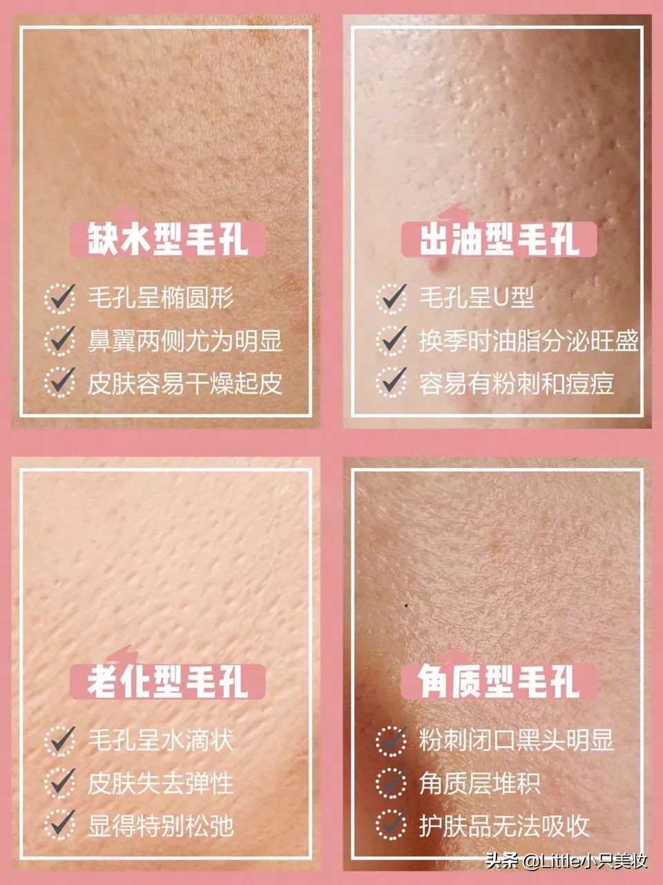 有了这5个护肤秘诀颜值不下降,有效改善毛孔粗大的好物推荐