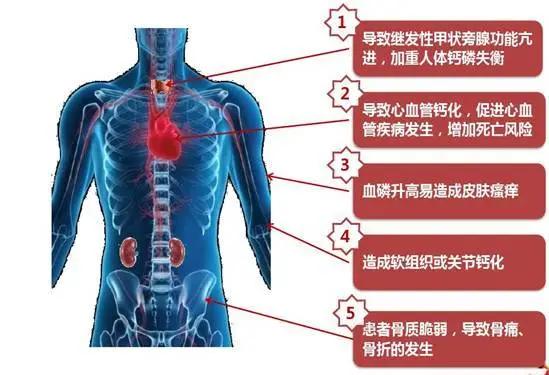 慢性肾衰高磷高钙怎么办,慢性肾脏病患者高磷血症的治疗