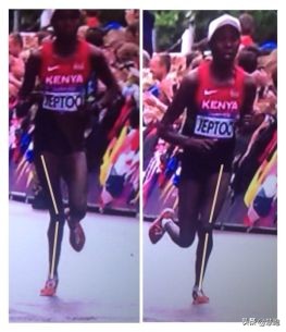 美国物理治疗膝前疼,美国膝关节炎治疗系统