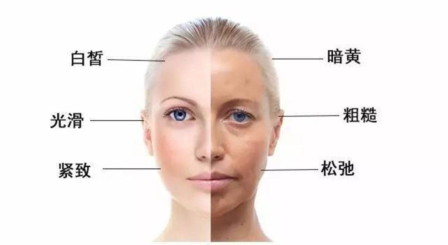 脸部暗黄怎样可以美白,暗黄粗糙黄脸婆