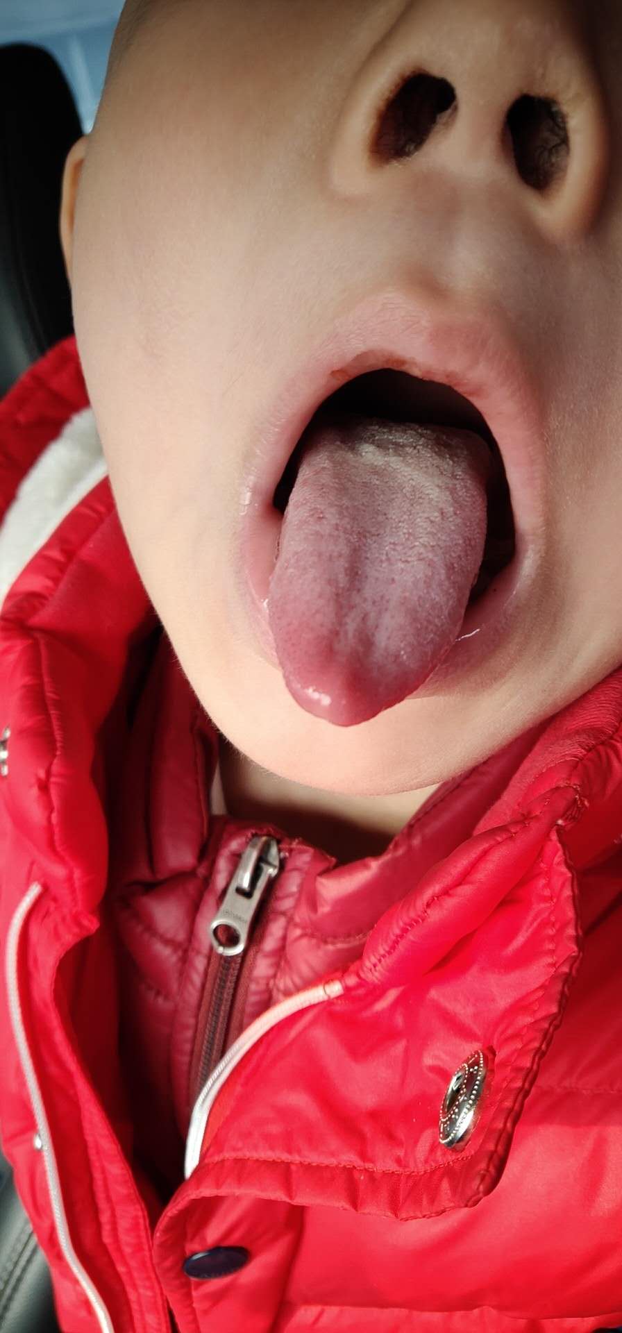 紧急通知:今冬流感的病因找到了,最简单的中医预防方法在此!