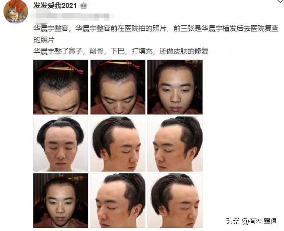 乌龙事件？网曝华晨宇整容网友否认其整容，称照片与前经纪人有关