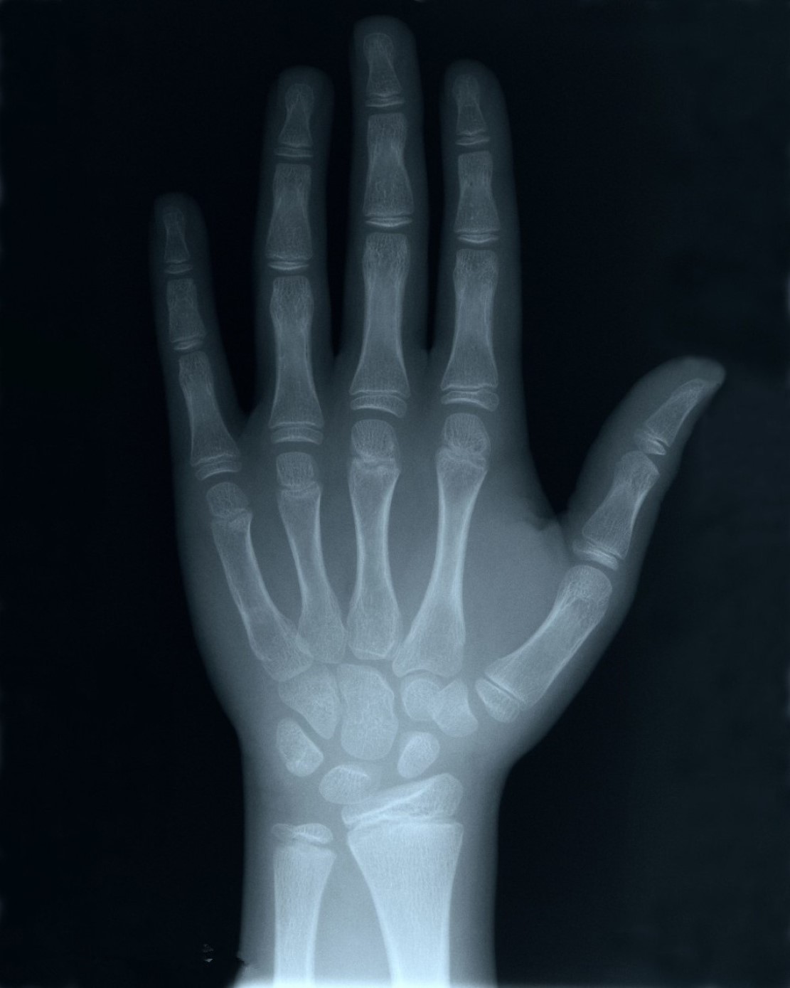 什么是x射线y射线,什么是x射线检测