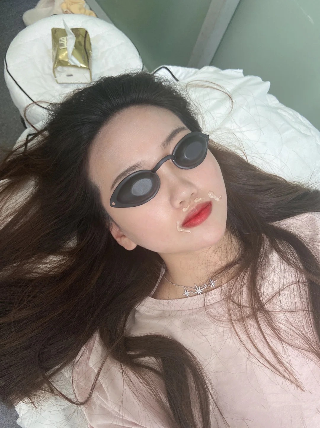 女生长胡子怎么去除最简单的方法,女性嘴角边长胡子是怎么去除