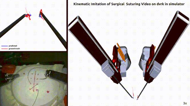 谷歌联手伯克利给机器人上网课！观看8位医生手术视频学缝合