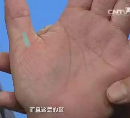 手的10大疾病征兆,手诊10种常见病从手上就能看出来
