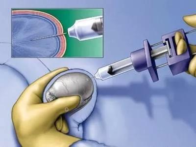 一文读懂颈动脉彩超,一文读懂肿瘤基因检测
