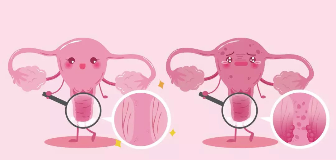 女性在什么情况下要做tct,做TCT检查有什么危害