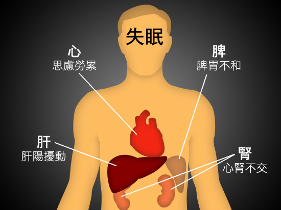 除了中药还有什么办法治失眠,月经量少失眠挂什么中医科