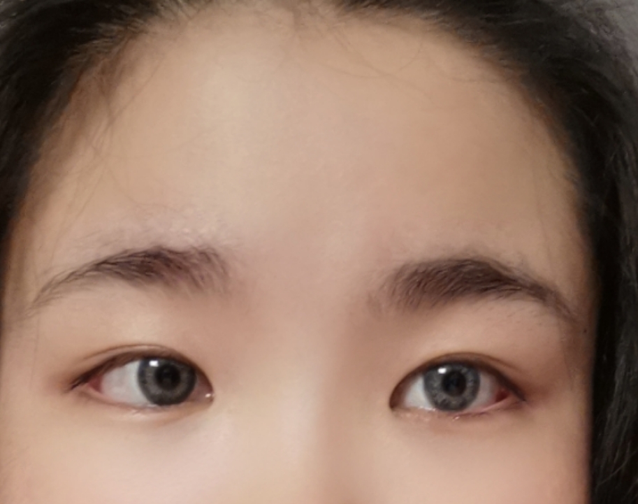 还在纠结戴不戴眼镜,为什么小孩不建议戴美瞳