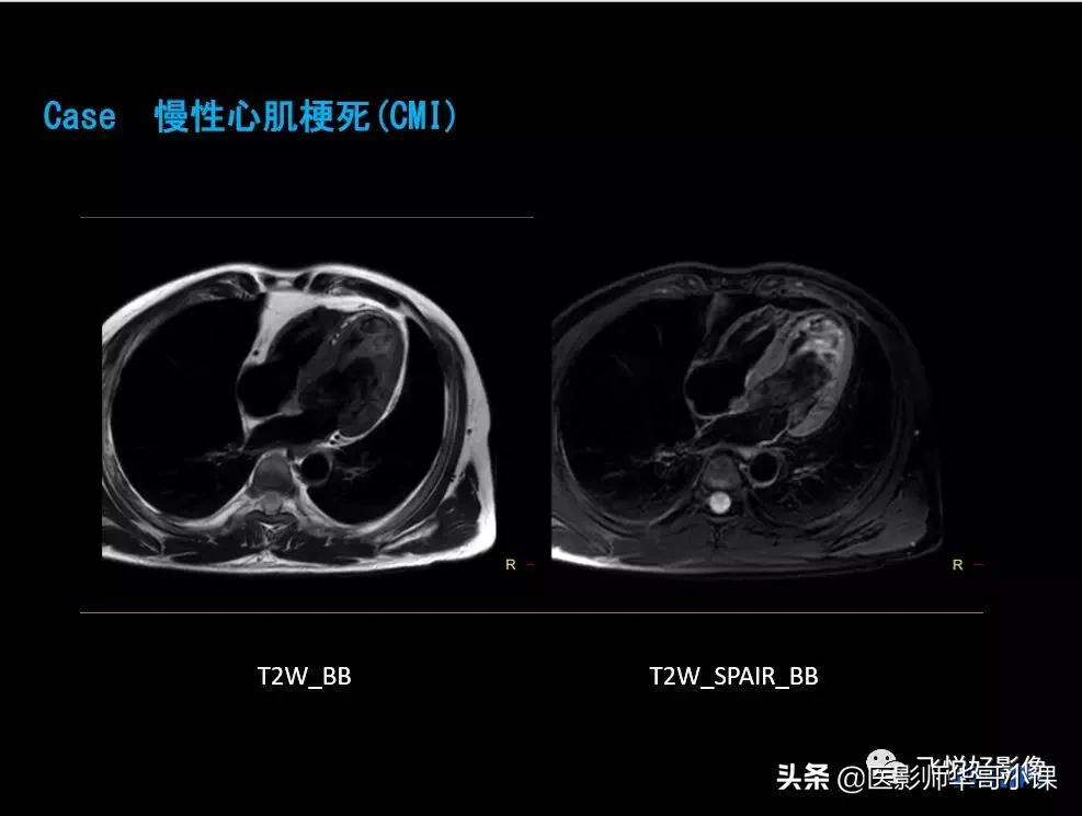 飞利浦多磁源核磁共振,飞利浦磁共振图像操作