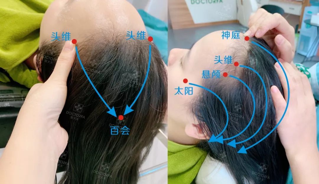 专家推荐治疗脱发白发食疗药酒,中医调理白发脱发养发