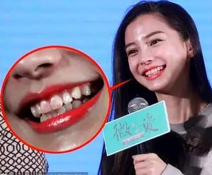 夏季脱妆怎么办,夏天脱妆的7个小技巧