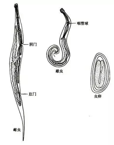 惊!三更半夜,孩子的“菊花”爬出了N条虫……