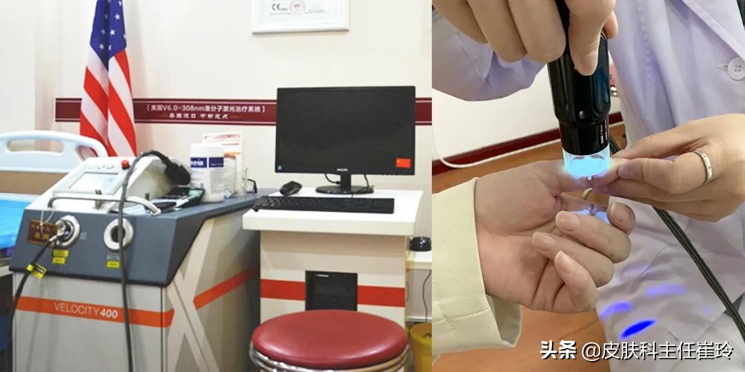 关爱白癜风患者公益援助活动,白癜风银屑病公益援助项目计划