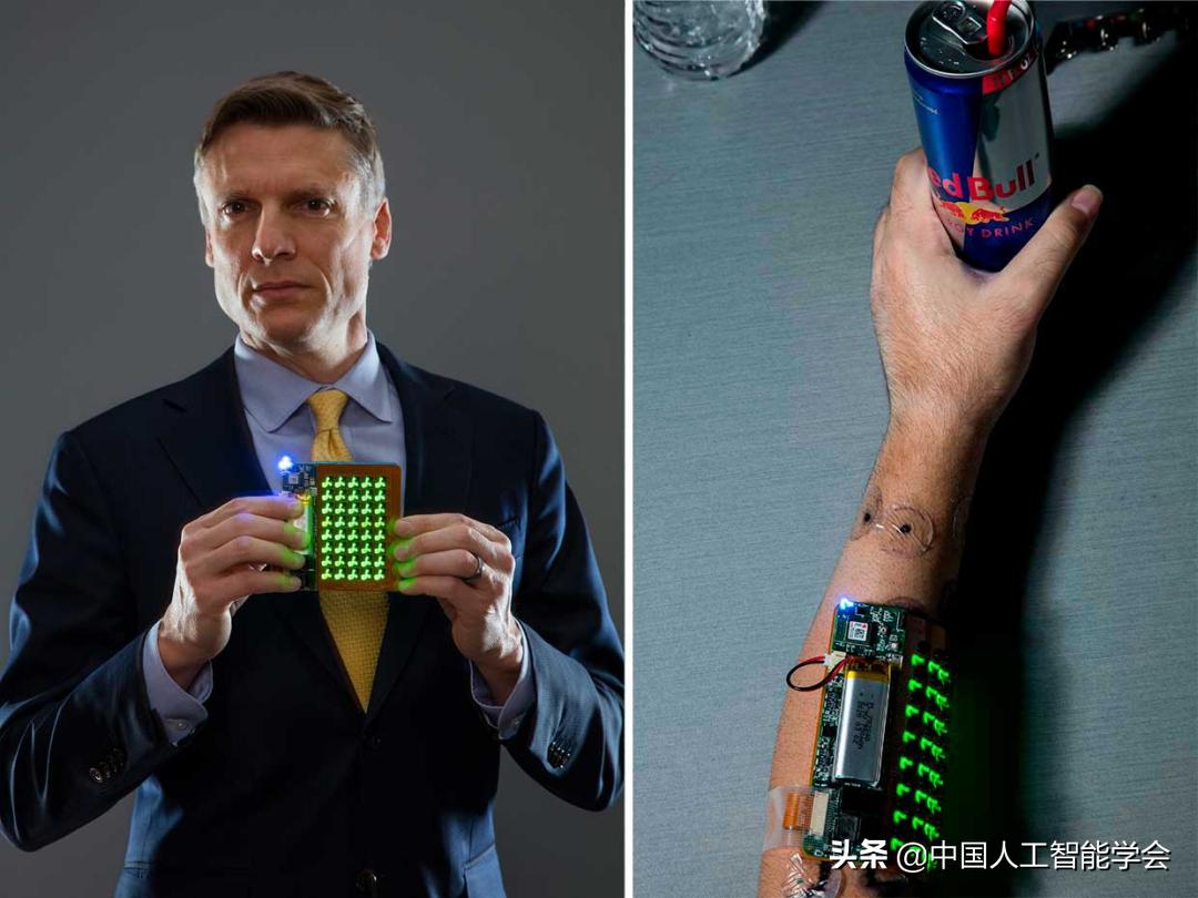 一千个电极植入大脑,大脑植入微电极