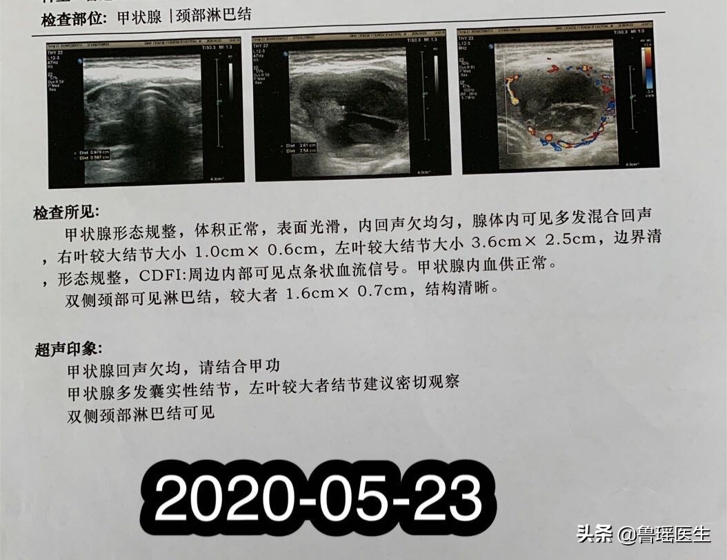 手术造成甲状旁腺损伤,牙齿增生手术全过程