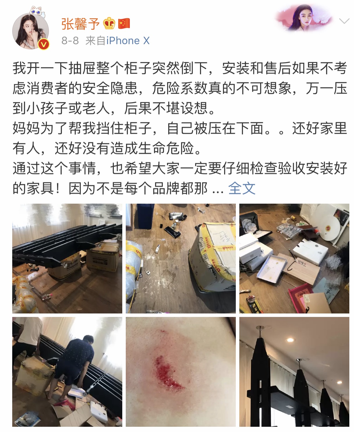 张馨予找代购被骗怎么回事,张馨予买的消毒液是真的吗