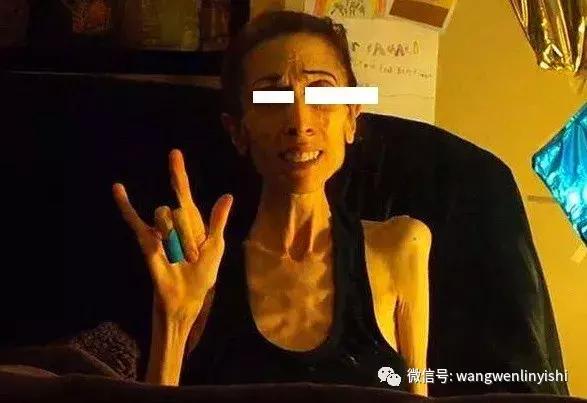 扁平胸的病机,猫崽扁平胸的病因