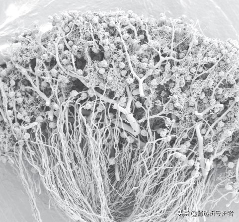 没有一个肾脏还能活吗,如果两个肾都没有了会怎样