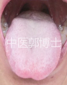 大便次数多用什么中药丸,大便次数多经方治疗