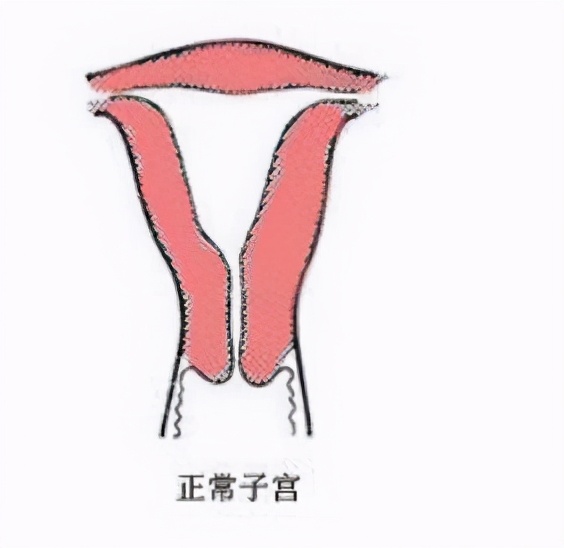 纵膈子宫可以一面放一个胚胎么,纵膈子宫可以剖腹产吗