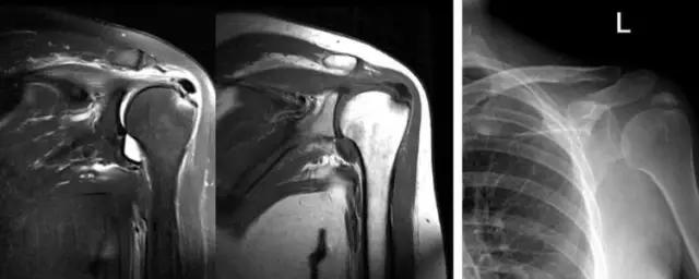 mri临床医师必读电子书,临床医生如何读mri
