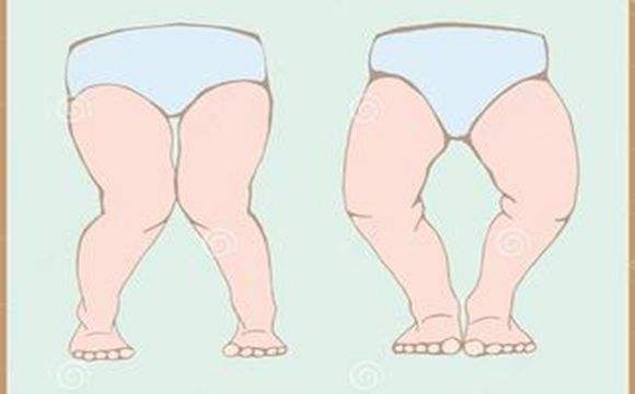 想要宝宝腿型好看怎么办,想要小孩长得好看吃什么