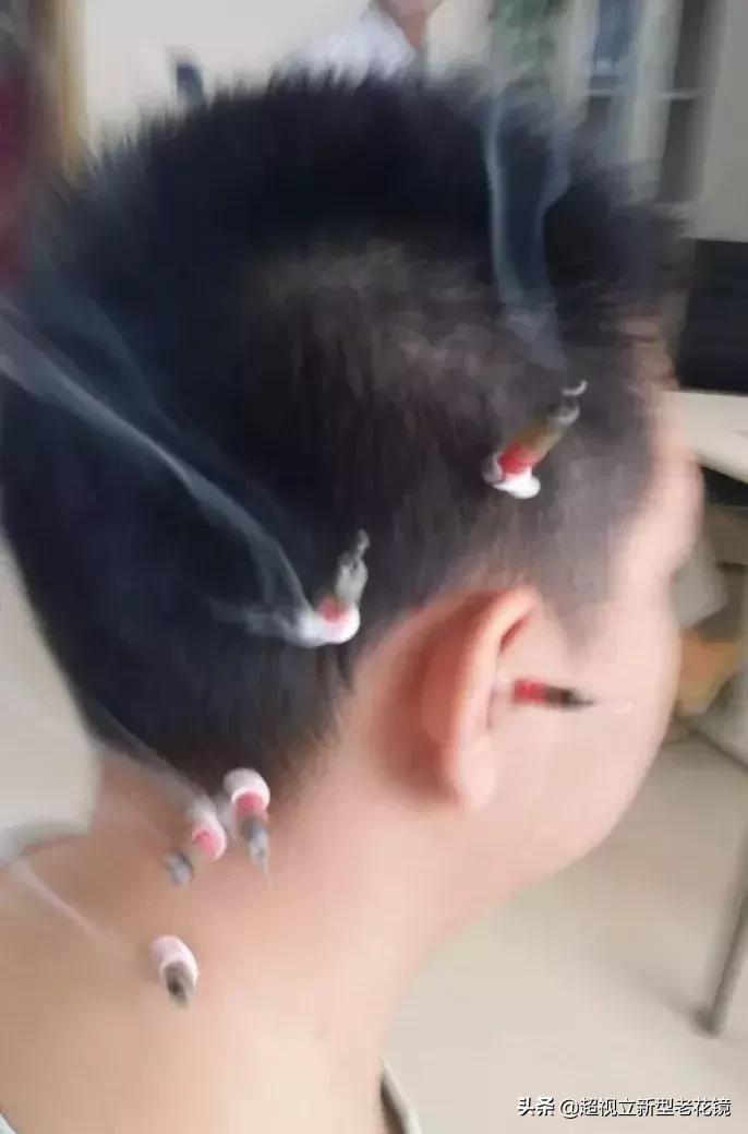 眼球为什么会变长导致近视,眼球为什么会亮