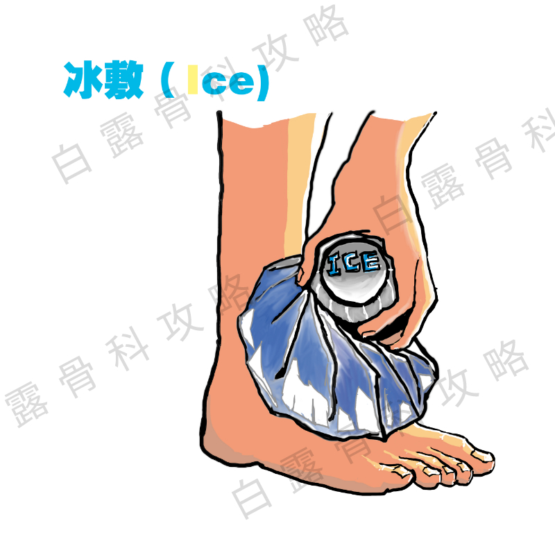 踝关节扭伤紧急处理,踝关节扭伤紧急处理视频