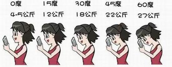 神经根型颈椎病重要特征,颈椎病各类型占比