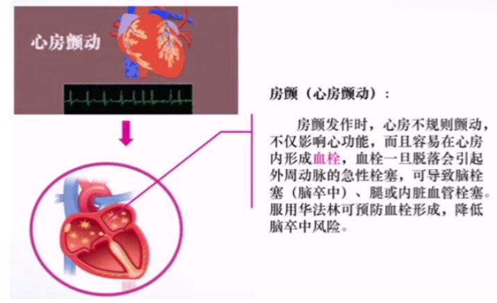 华法林长时间服用的副作用有哪些,华法林和小苏打能一起服用吗
