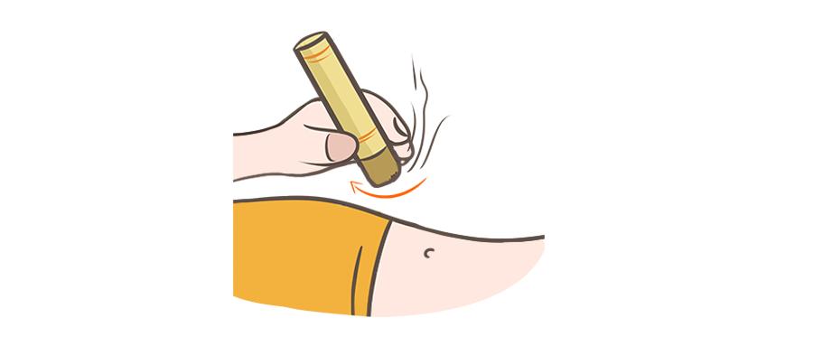 朱迅生病真相揭秘,朱迅艾灸